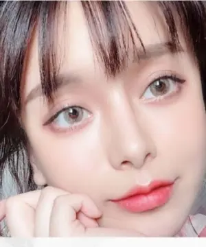 開眼頭手術|台中瑞星醫美診所
