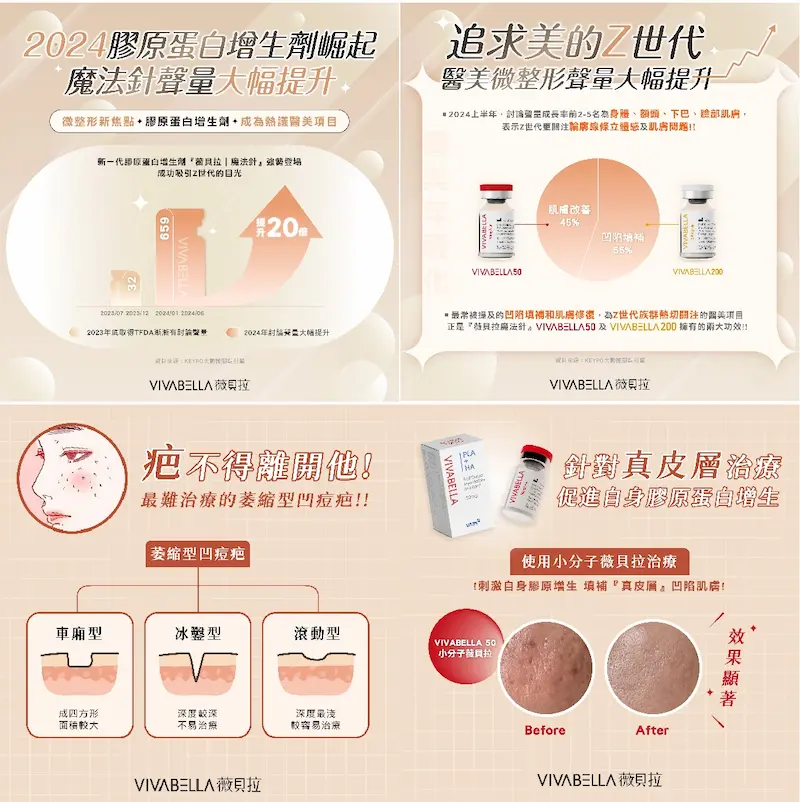 台中薇貝拉魔法針