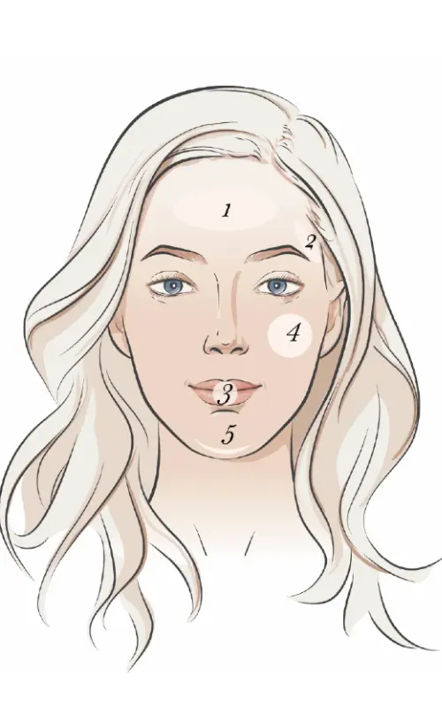 果薇斯玻尿酸美夢針|中分子蜂巢結構玻尿酸╳效果持久