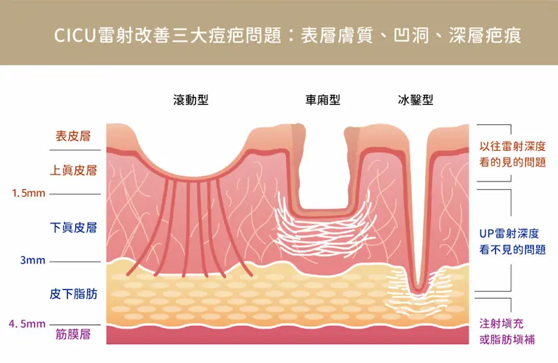 台中飛梭雷射