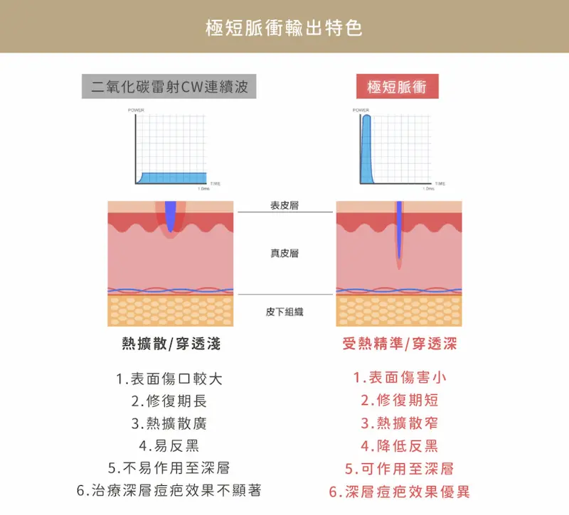 台中飛梭雷射
