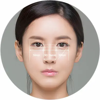 台中開眼頭手術
