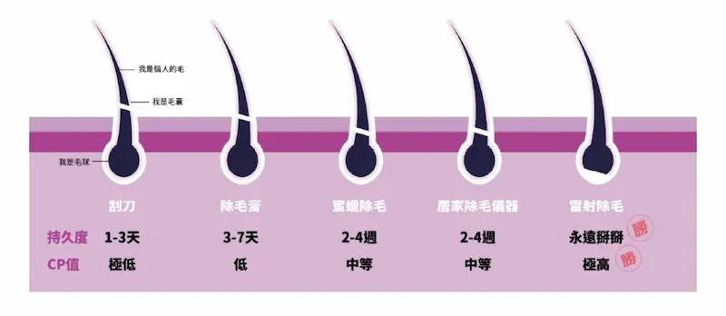 雷射除毛