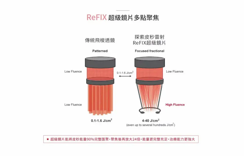 台中探索皮秒特色