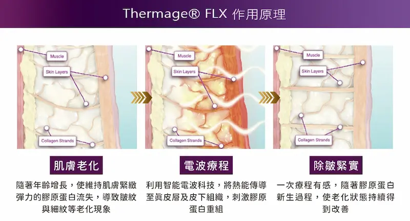 台中FLX鳳凰電波2m