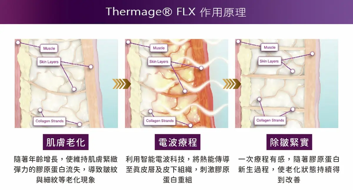 台中FLX鳳凰電波2