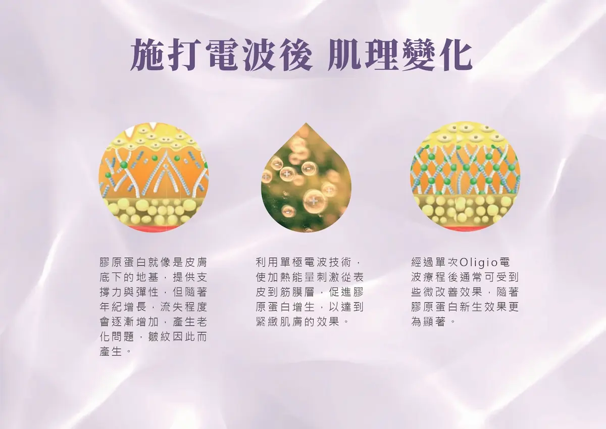 台中Oligio玩美電波