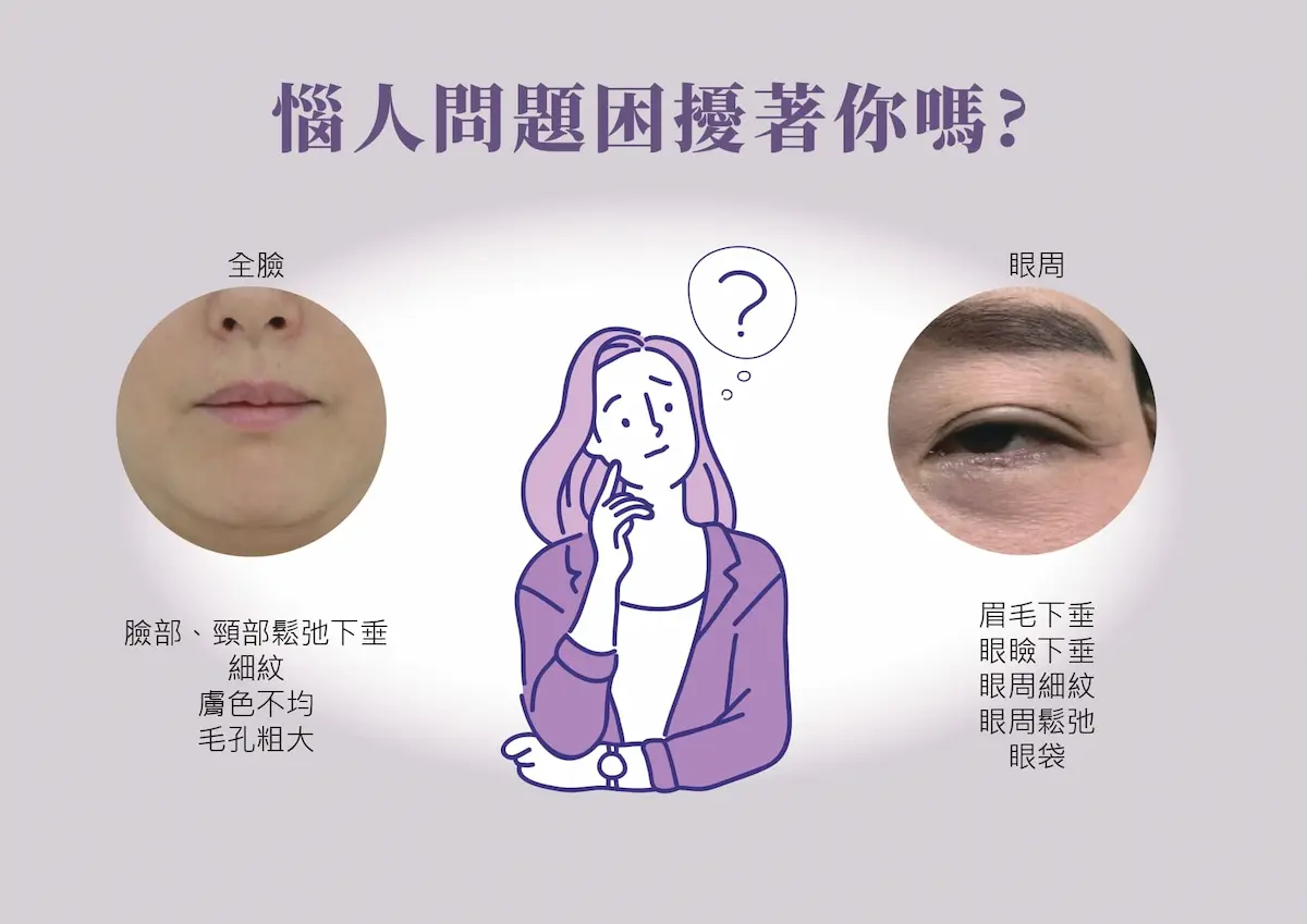 Oligio玩美電波